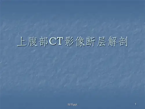 上腹部CT影像断层解剖