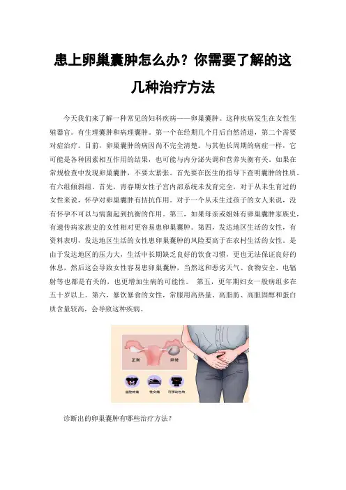 患上卵巢囊肿怎么办？你需要了解的这几种治疗方法