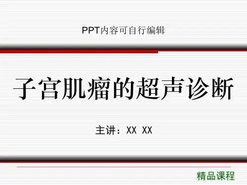 子宫肌瘤的超声诊断PPT精品课程课件讲义