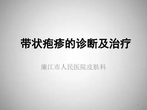 带状疱疹的诊治PPT幻灯片课件