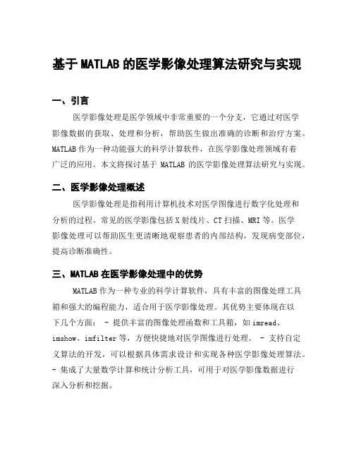 基于MATLAB的医学影像处理算法研究与实现