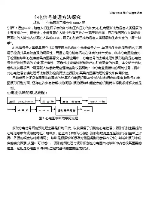 (完整word版)心电信号处理