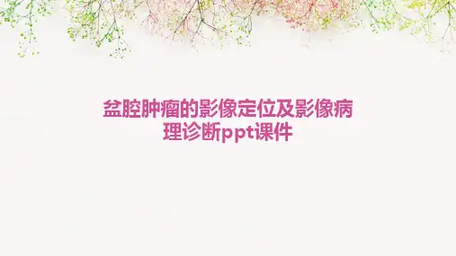 盆腔肿瘤的影像定位及影像病理诊断ppt课件
