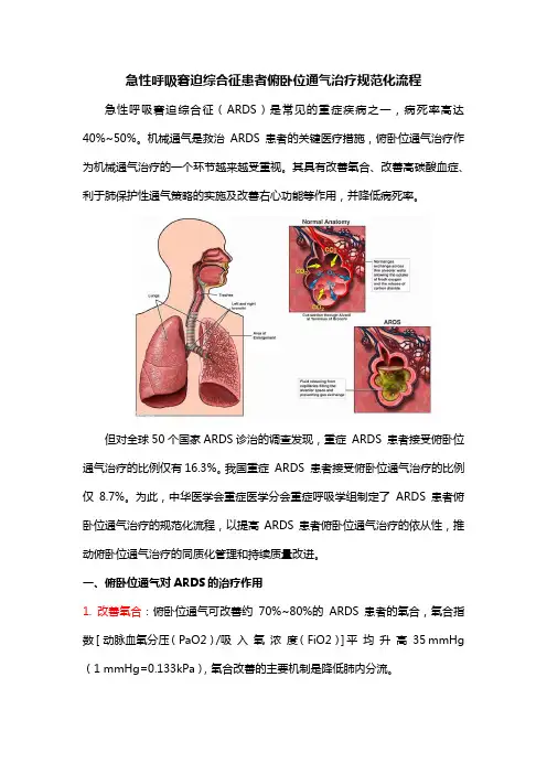 急性呼吸窘迫综合征患者俯卧位通气治疗规范化流程
