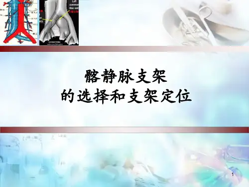 髂静脉支架的选择和支架定位PPT培训课件