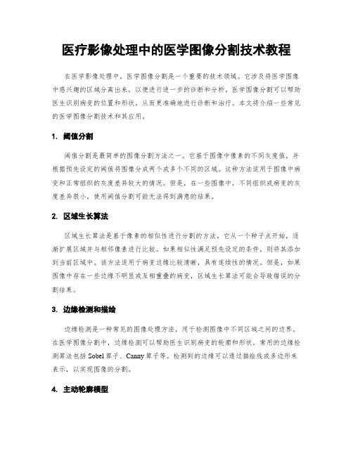 医疗影像处理中的医学图像分割技术教程