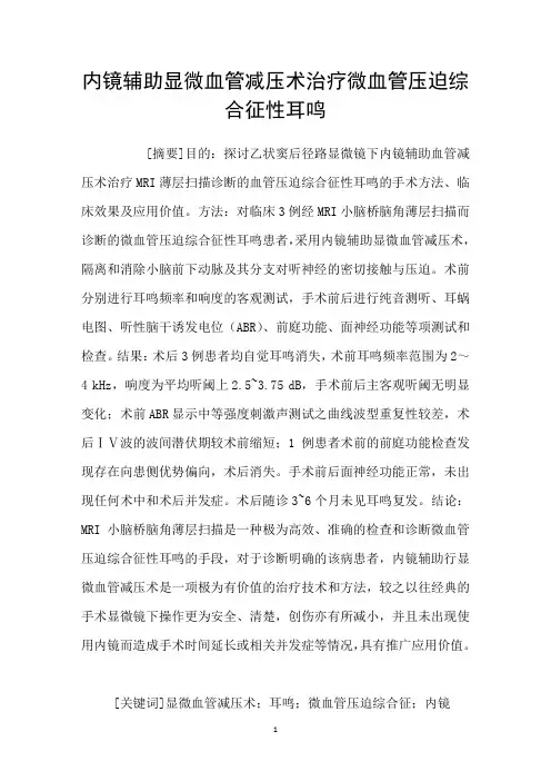 内镜辅助显微血管减压术治疗微血管压迫综合征性耳鸣