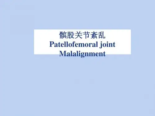 髌股关节紊乱