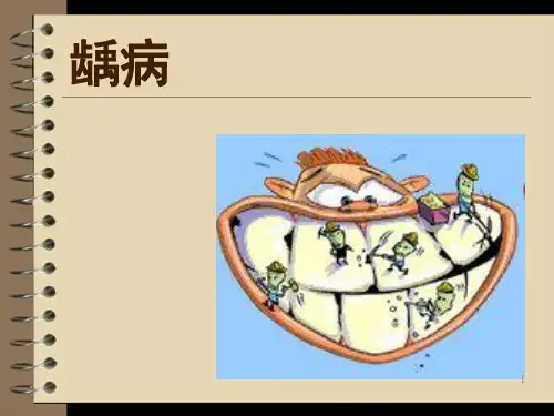 龋病ppt课件