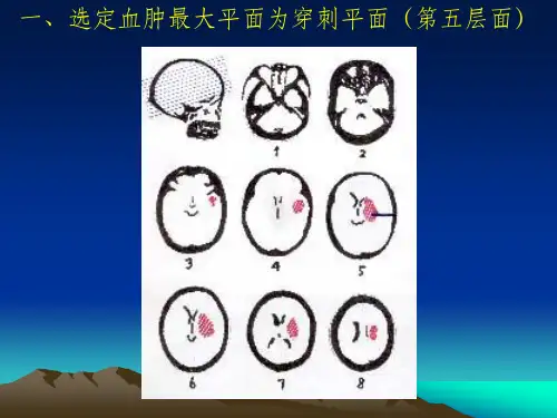 CT定位方法
