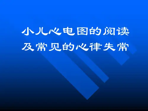 小儿心电图讲解
