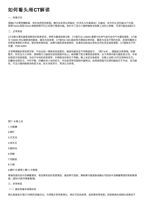 如何看头颅CT解读