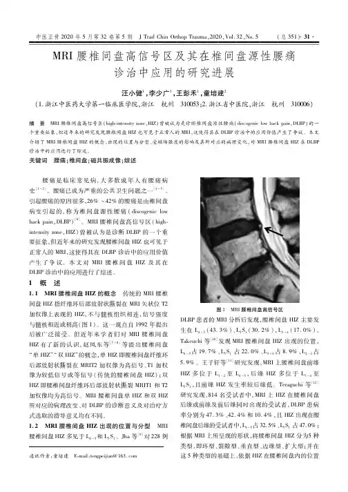 MRI腰椎间盘高信号区及其在椎间盘源性腰痛诊治中应用的研究进展