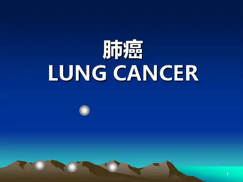 肺癌-优秀医学PPT课件