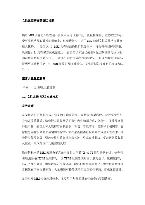 女性盆腔病变的MRI诊断