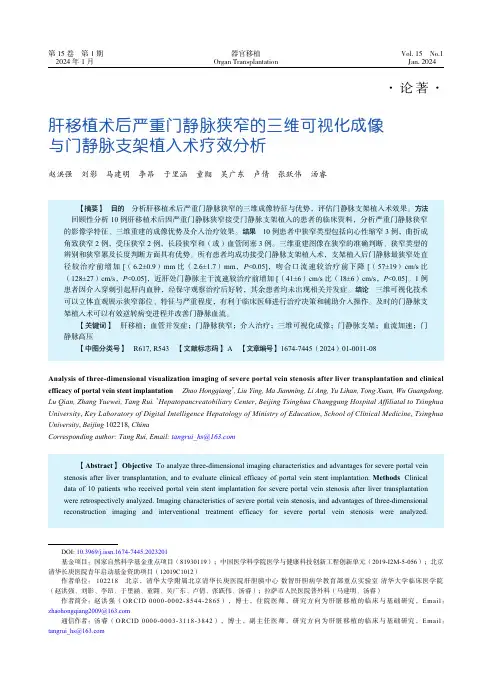 肝移植术后严重门静脉狭窄的三维可视化成像与门静脉支架植入术疗效分析