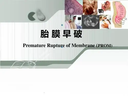 胎膜早破、胎膜早剥和前置胎盘总结ppt课件