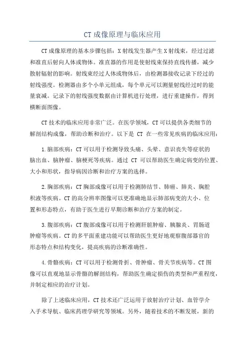 CT成像原理与临床应用