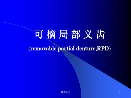 口腔修复学可摘局部义齿  ppt课件