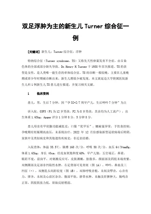 双足浮肿为主的新生儿Turner综合征一例