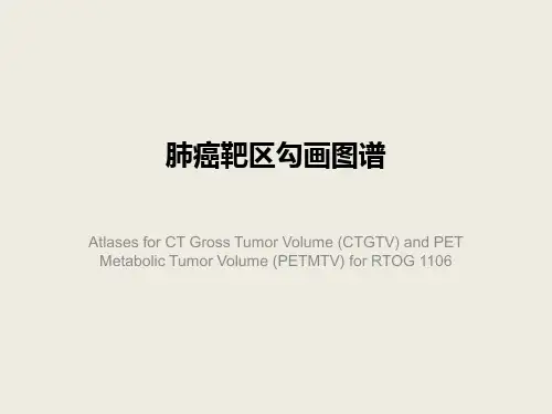 肺癌靶区勾画图谱