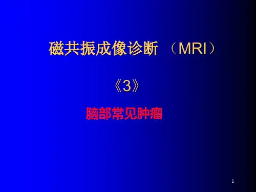 磁共振成像诊断MRI脑部常见肿瘤PPT课件