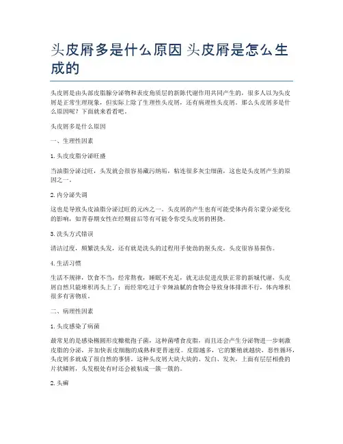 头皮屑多是什么原因-头皮屑是怎么生成的