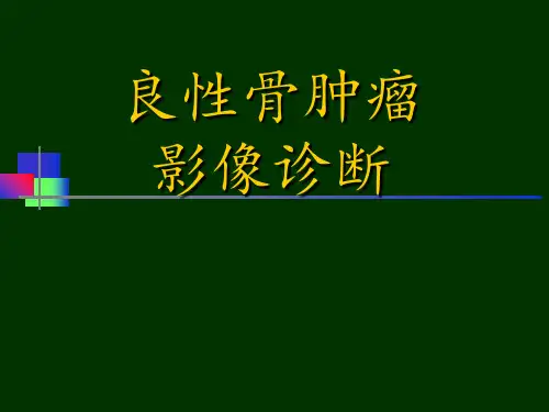 良性骨肿瘤影像诊断 ppt课件
