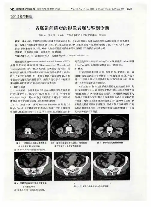 胃肠道间质瘤的影像表现与鉴别诊断
