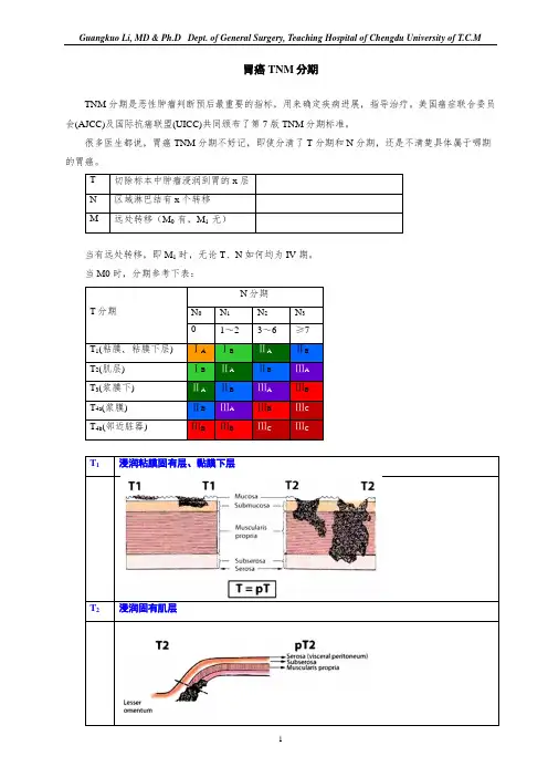 胃癌TNM分期