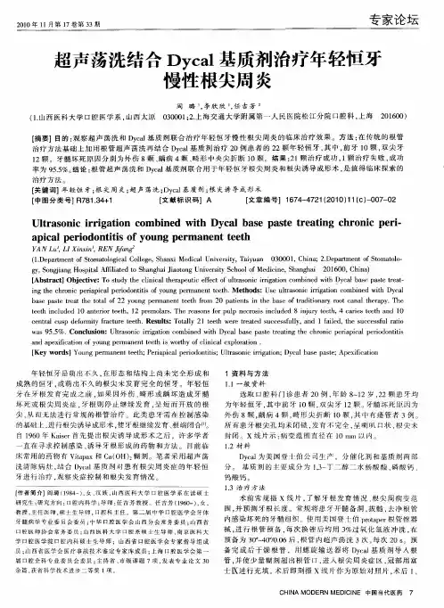 超声荡洗结合Dycal基质剂治疗年轻恒牙慢性根尖周炎