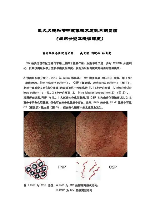 放大内镜和窄带成像技术发现早期胃癌