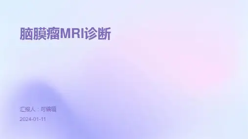 《脑膜瘤MRI诊断》PPT课件