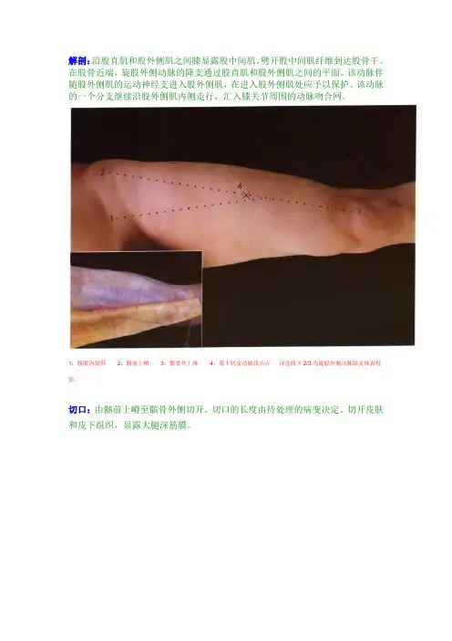 股骨前外侧入路