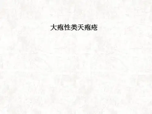 大疱性类天疱疮医学PPT课件