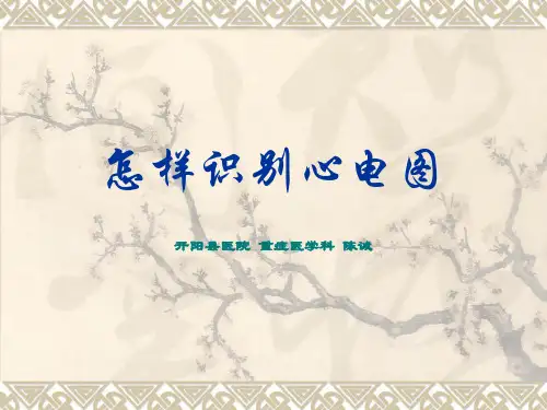 急诊心电图的识别与处理
