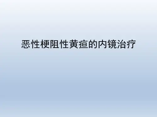 恶性梗阻性黄疸的内镜治疗