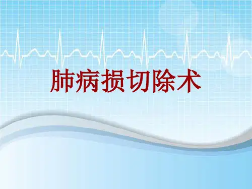 手术讲解模板：肺病损切除术