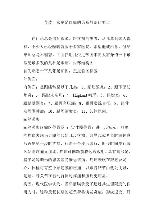 荐读：常见足跟痛的诊断与治疗要点