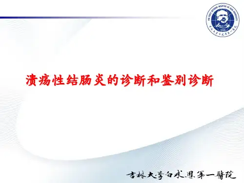 溃疡性结肠炎的诊断与鉴别诊断
