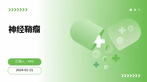 神经鞘瘤概述演示课件