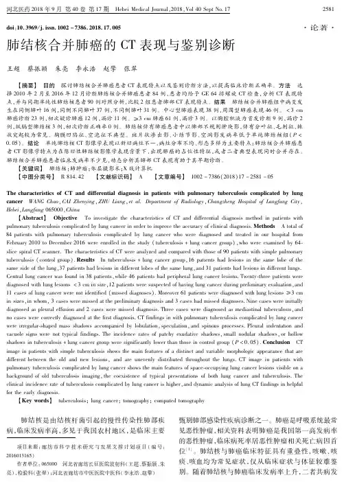 肺结核合并肺癌的CT表现与鉴别诊断