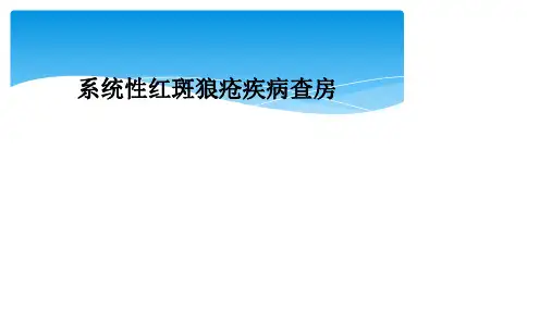 系统性红斑狼疮疾病查房
