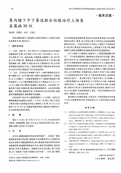 鼻内镜下中下鼻道联合径路治疗上颌窦真菌病30例