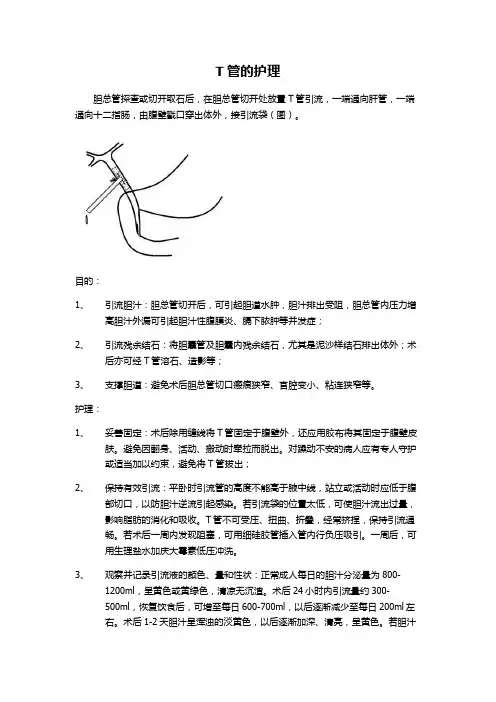 T管的护理