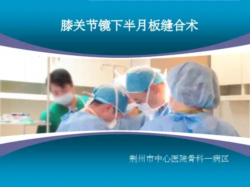 关节镜下半月板缝合术ppt课件