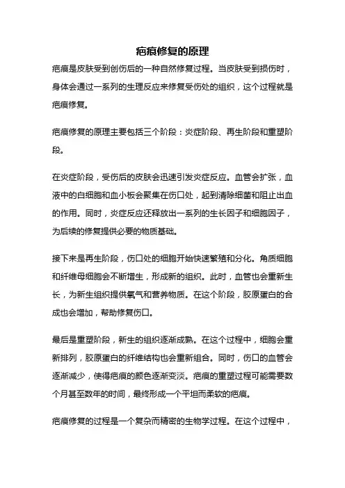 疤痕修复的原理