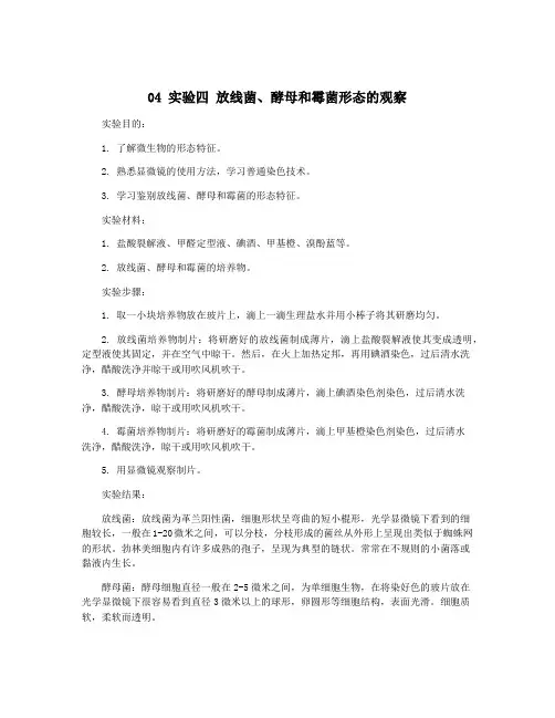 04 实验四 放线菌、酵母和霉菌形态的观察