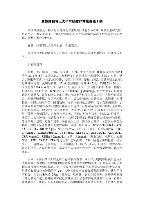 真性阔韧带巨大平滑肌瘤伴粘液变性1例