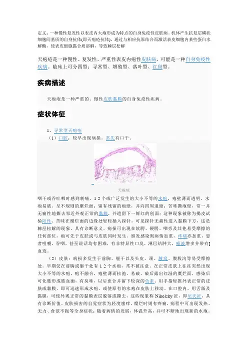 天疱疮讲义